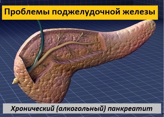 Проблемы с поджелудочной