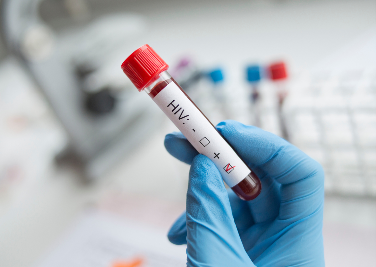 Пробирки для забора крови на ВИЧ.