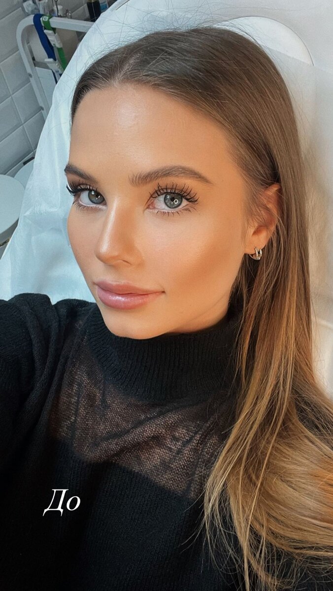    Лиана Шульгина снялась до "уколов красоты"Соцсети Лианы Шульгиной