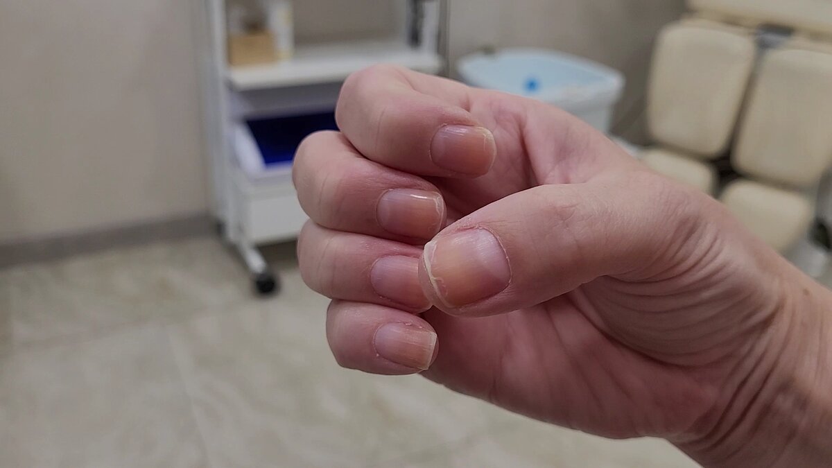 "Старые ногти"