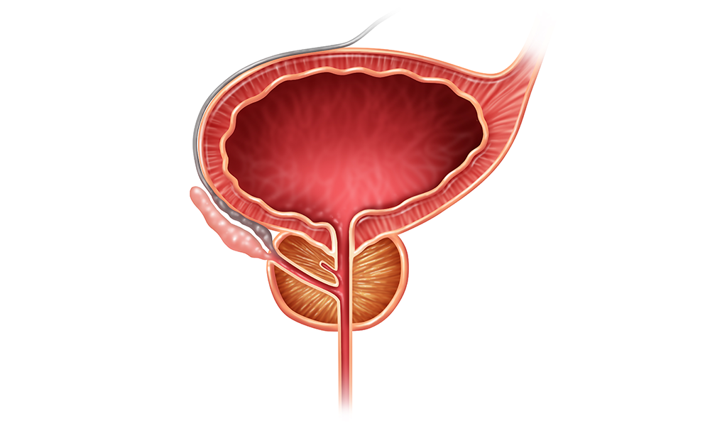 Простата это железа. Анатомия предстательной железы у мужчин. Анатомия мочевого пузыря, простата. Анатомия аденомы предстательной железы. Предстательная железа в 3 д анатомия.