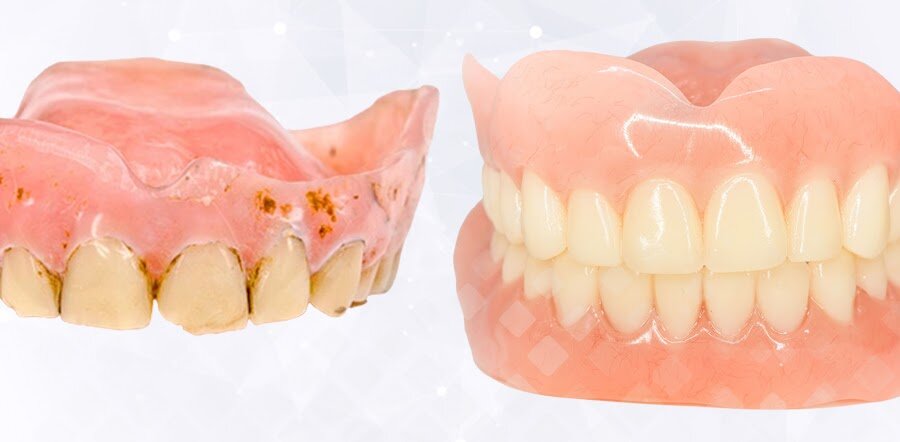 Что делать, если съемный зубной протез выпадает?