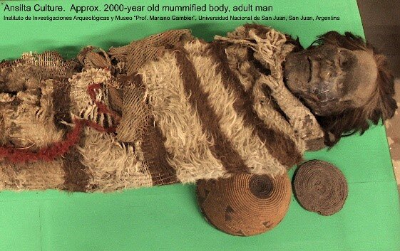 Исследователи обнаруживают древние модели миграции людей, анализируя ДНК мумии, зараженной вшами.