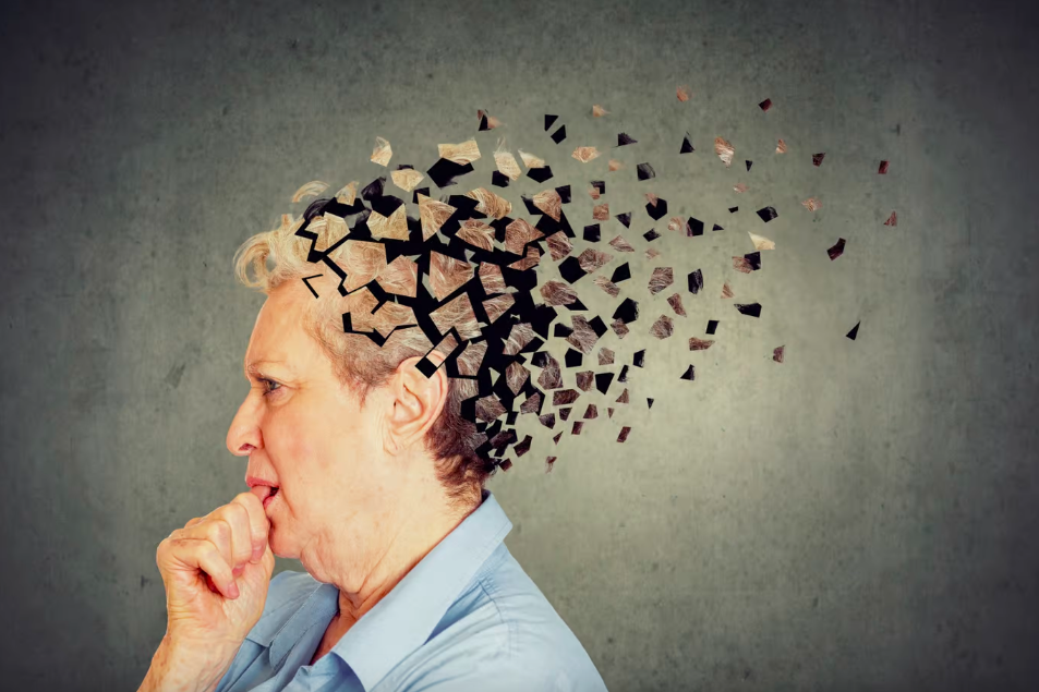     Заместительная гормональная терапия снизила риск развития деменции у женщин