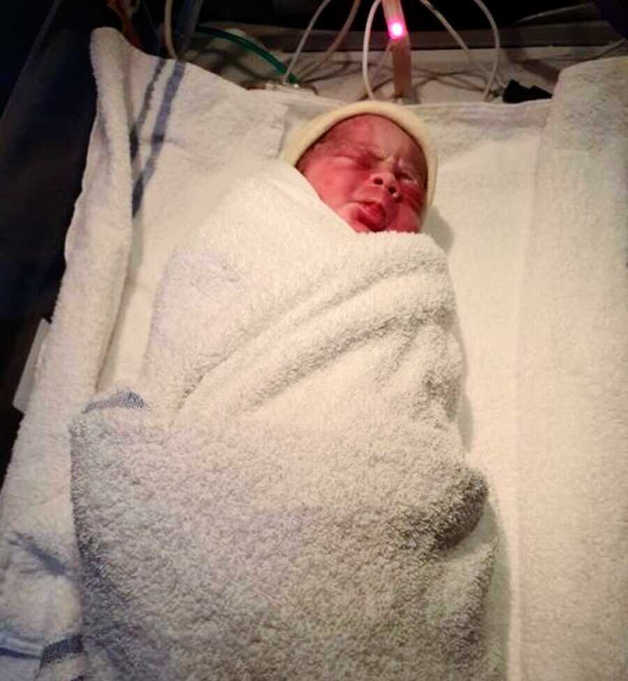 https://www.lovewhatmatters.com/parents-share-babys-journey-with-sturge-weber-syndrome/
