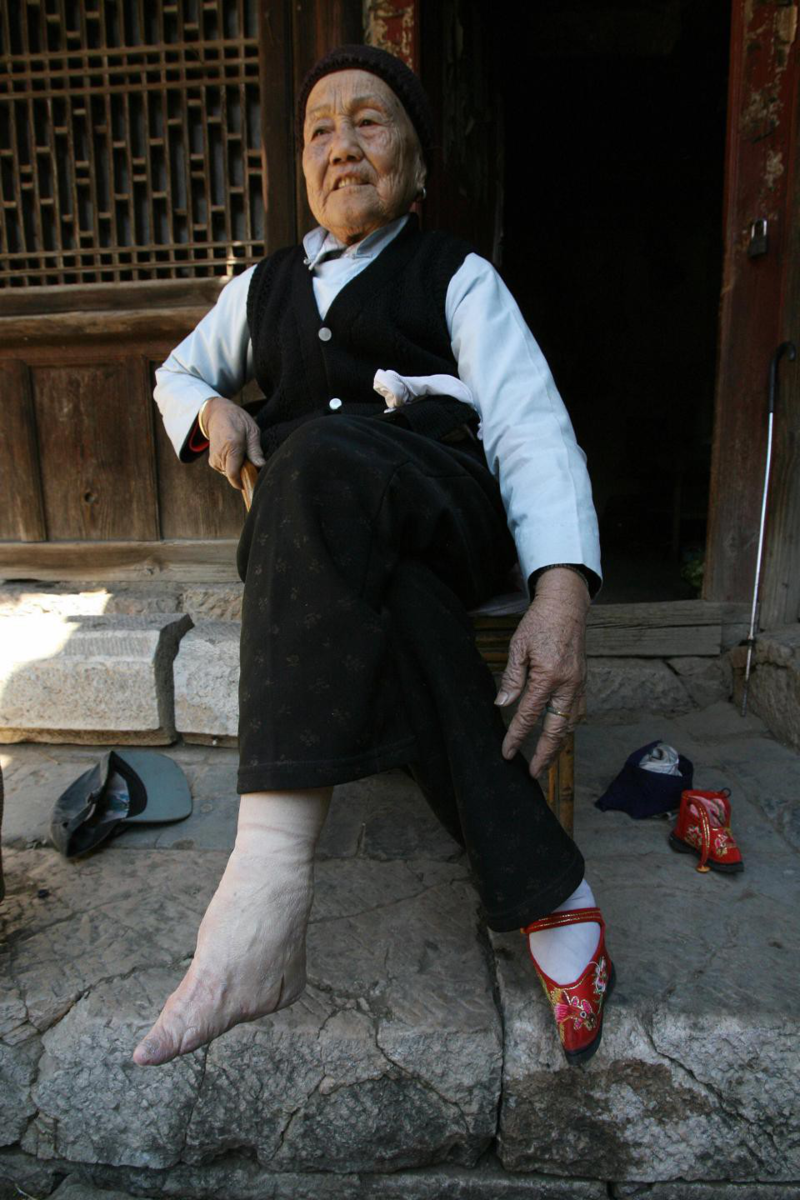 Ножки лотосы. Традиция бинтования ног в Китае. Китайские лотосовые ножки. Бинтование ног Лотос Китай. Золотой Лотос бинтование ног.