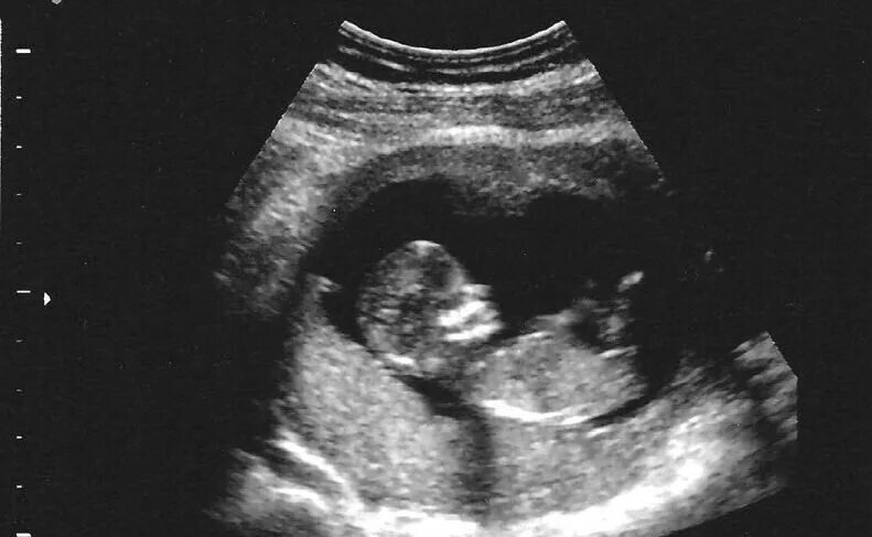 Из открытых источников. 