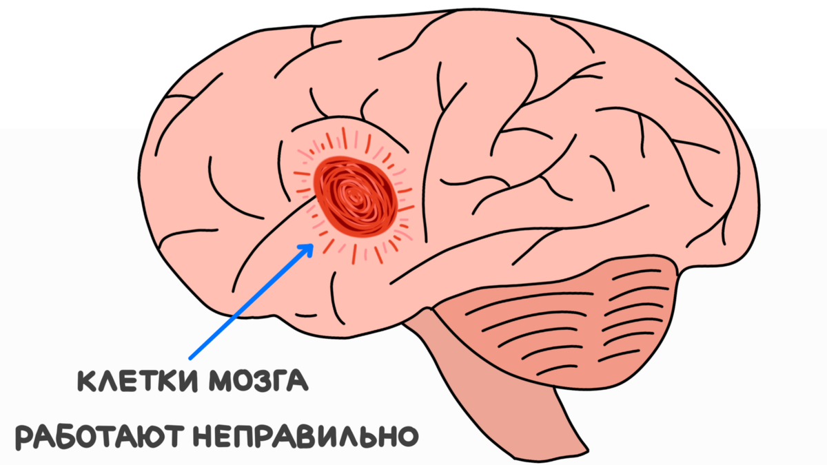 Dota cypher mode schizophrenia фото 89