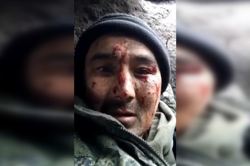     Оренбуржец попал под обстрел и чудом выжил. Ему предстоит длительная реабилитация. Фото: стоп-кадр с видео