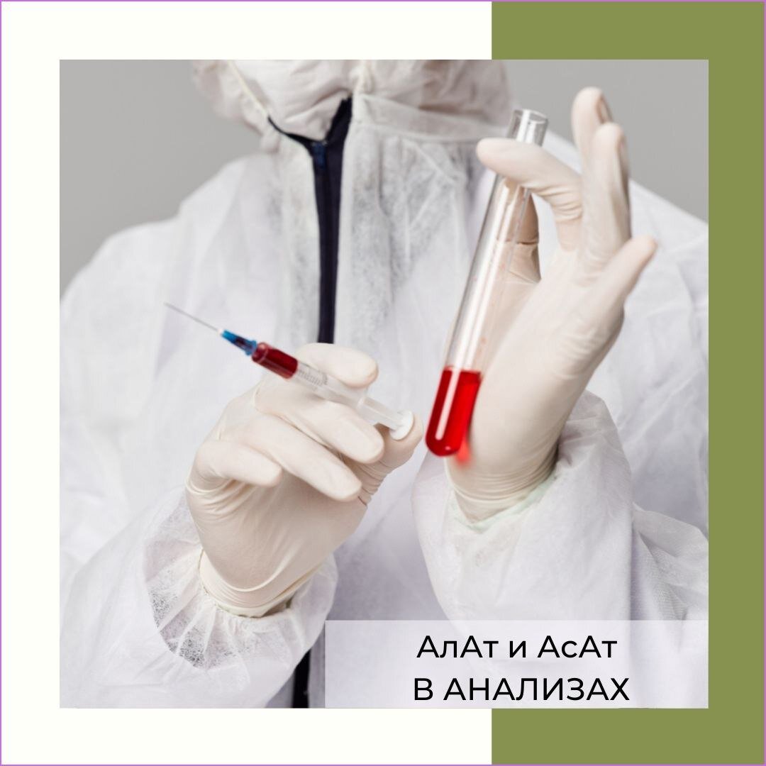АлАт и АсАт В АНАЛИЗАХ