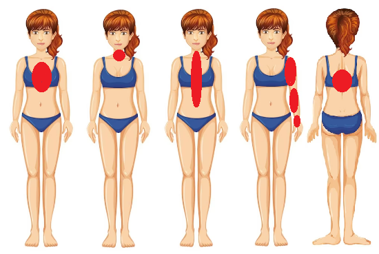 Варианты локализации ишемических болей