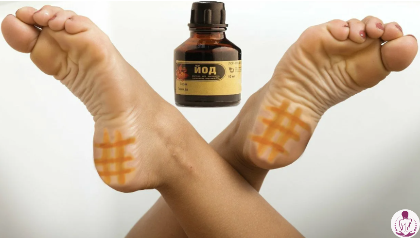 Сила йодной настойки. Йодная сетка на пятки поможет встать на ноги и вернуть здоровье!