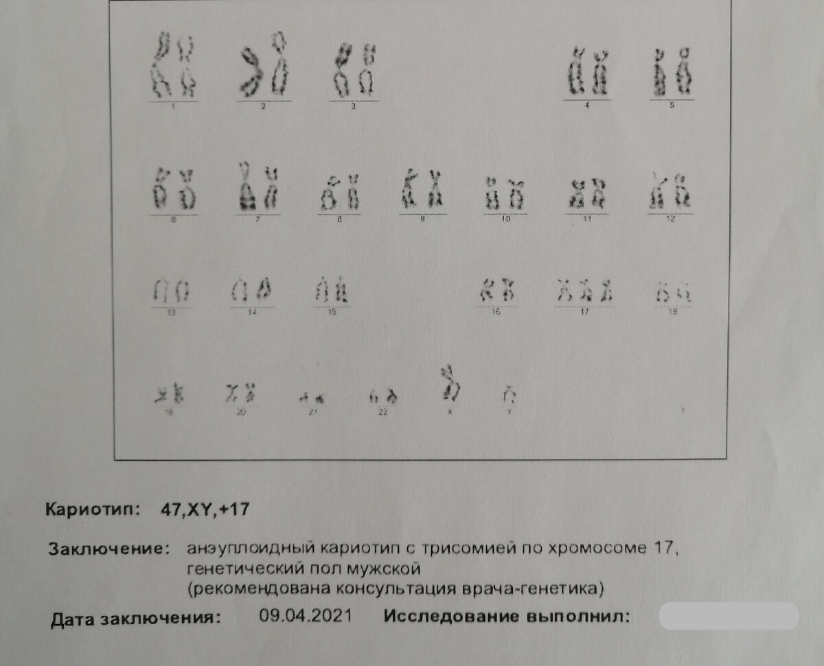 причина ЗБ примерно та же, как в первый раз