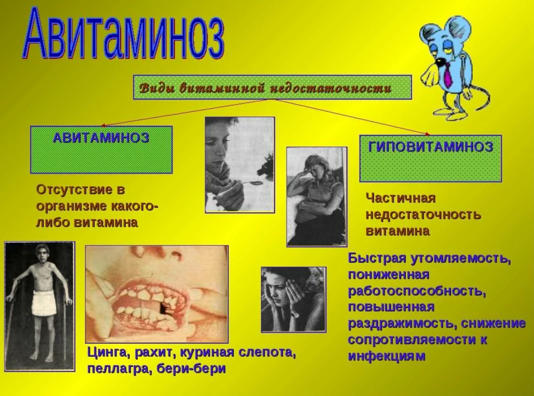 К чему может привести инфекция. Авитаминоз заболевания. Авитаминоз и гиповитаминоз. Витамин с авитаминоз и гиповитаминоз.