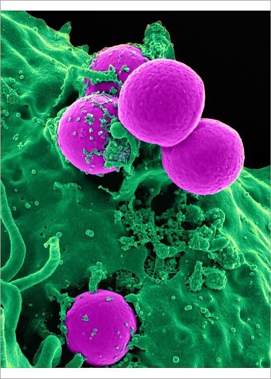 Лейкоцит (зеленый) поглощает стафилококк (розовый). Электронная микроскопия.                 Снимок: Media Storehouse.                        