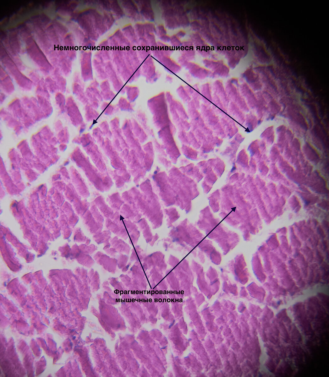 фото гистологического препарата кусочка филе курицы. Можно листать в право
