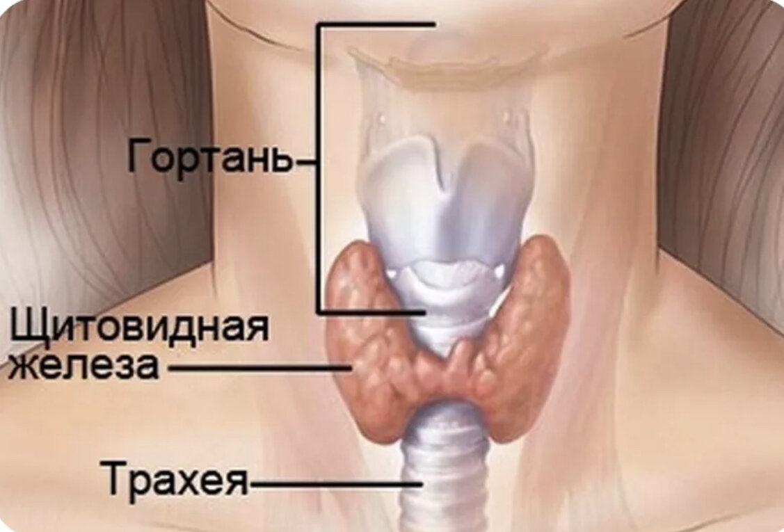 Атипия щитовидной железы. Где находится щитовидная железа. Гдемнаходится щитовидная железа. ГД енахолится щитовидная железа.