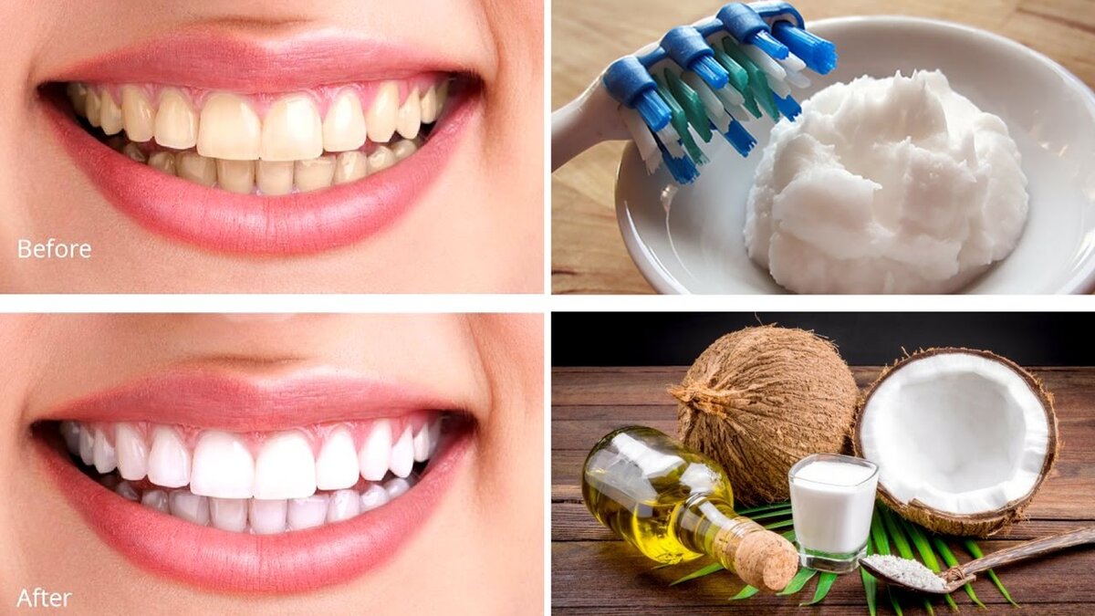 Натуральные зубные пасты и порошки в последнее время становятся очень популярными. Это не просто недорогие и безопасные способы ухода за зубами, но и зачастую более эффективные.-4
