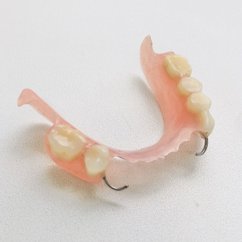 Какие зубные протезы лучше при отсутствии зубов. Пластинчатый микропротез. Съемный пластиночный протез. Частичный съемный пластиночный протез на нижнюю челюсть. Нейлоновый микропротез 1-3 зуба.