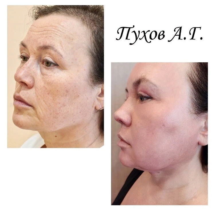 instagram: @doctor_puhov