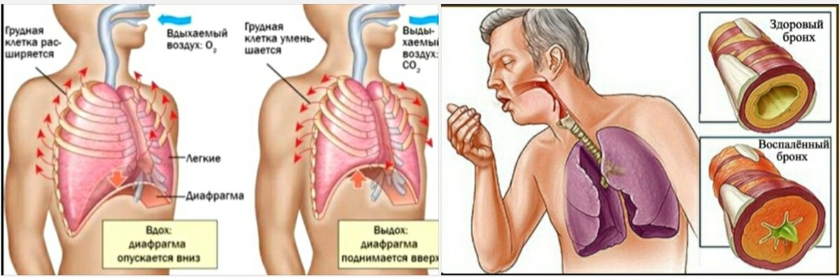 Слабость кашель мокрота насморк. Зелёная мокрота при кашле. Гнойная мокрота при кашле. Желто зеленая мокрота при кашле.