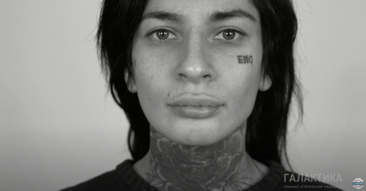 Пациентка Гоар