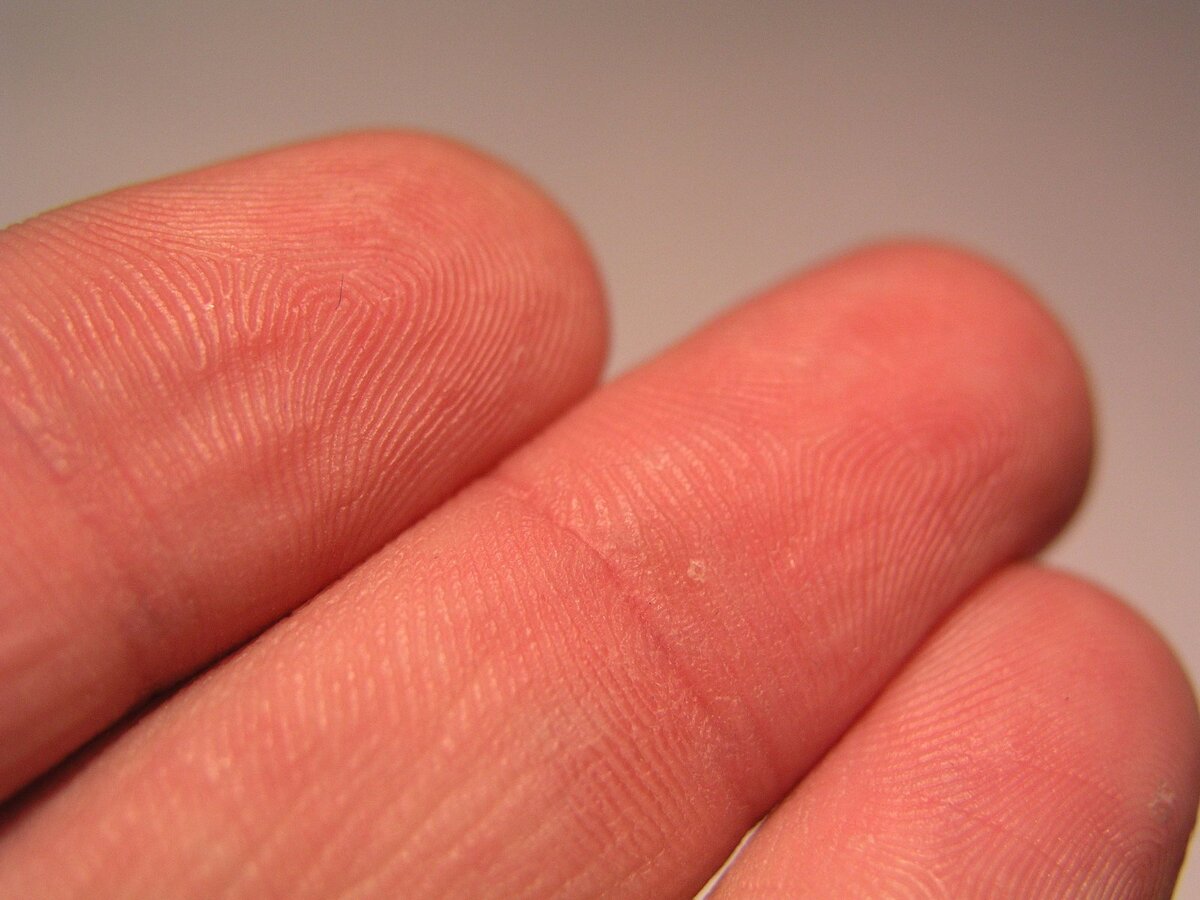 Папиллярные линий на пальцах руки