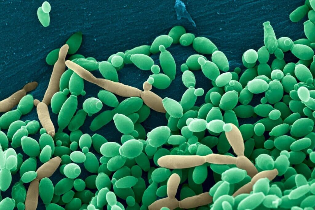    Candida tropicalis — распространенный грибковый патоген, который обнаруживается и в опухолях / ©Djspring, Wikimedia Commons