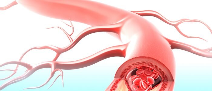                                                                                   Иллюстрация: sino-medis.com