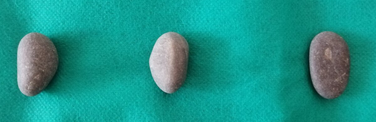 Скандинавские руны. Авторское фото