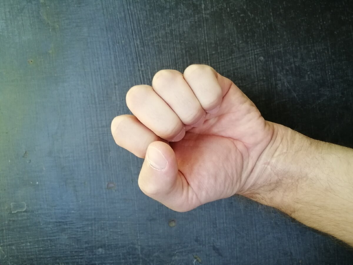 В юношеском возрасте на тренировке ушиб кисть, да больно пару недель очень, а потом да и ладно пройдёт. Учитывая то что молодой организм заживает всё моментально. Но пол года, не правильные резкие движения или не правильно поставленный удар по мешку давал знать о травме.