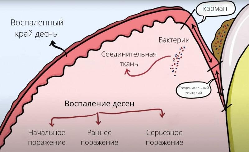 Причины зуда в деснах и зубах у взрослого человека