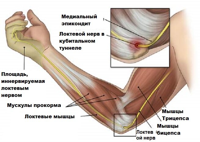 [caption id="attachment_1827" align="aligncenter" width="655"] Что происходит внутри при защемлении[/caption]