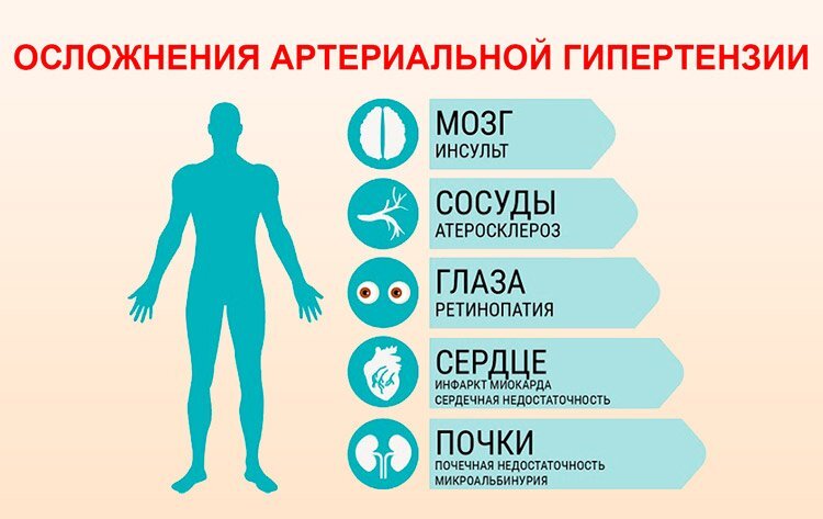 Осложнения гипертонической болезни картинки