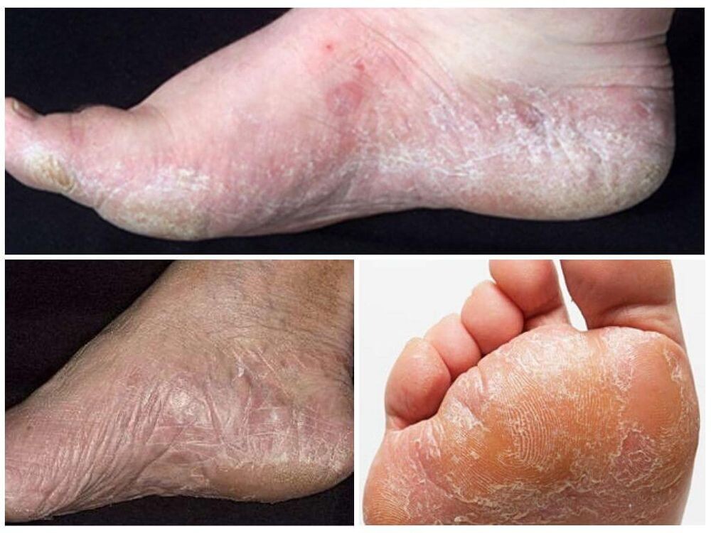 Фото: vros-nogot.ru