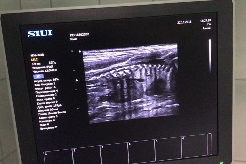 УЗИ беременности кошки, срок 60 дней