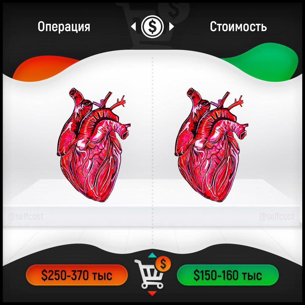 Стоимость органов картинки