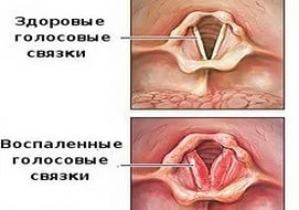 Источник Яндекс. Картинки