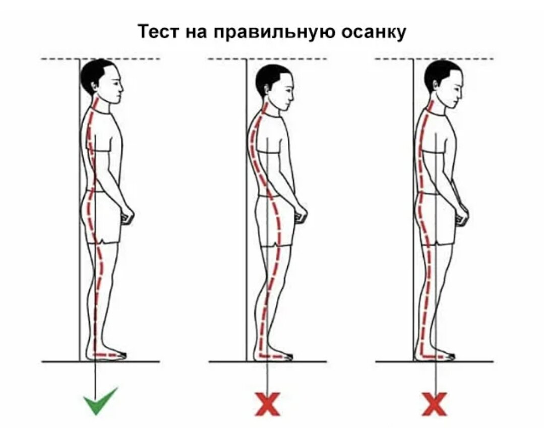 Тестовая карта для выявления нарушений осанки по с н попову