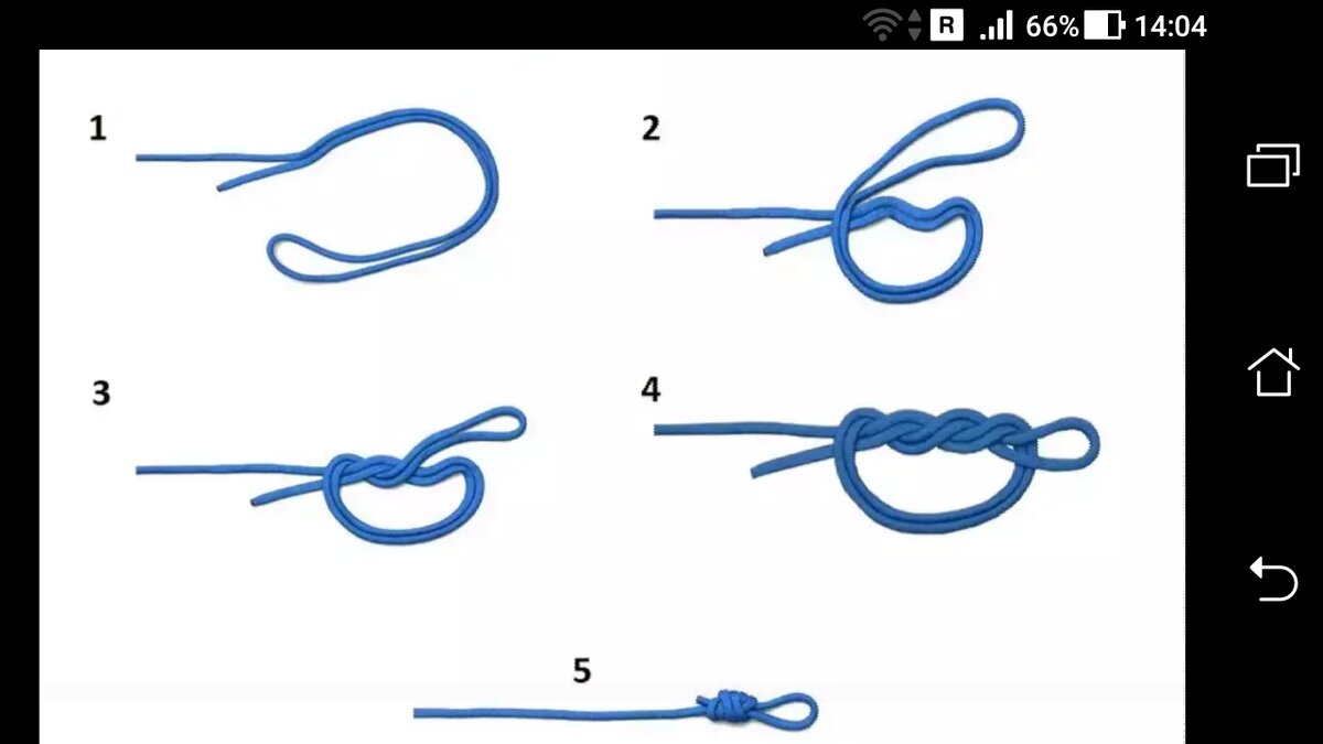 фото рисунок - Узел хирургическая петля