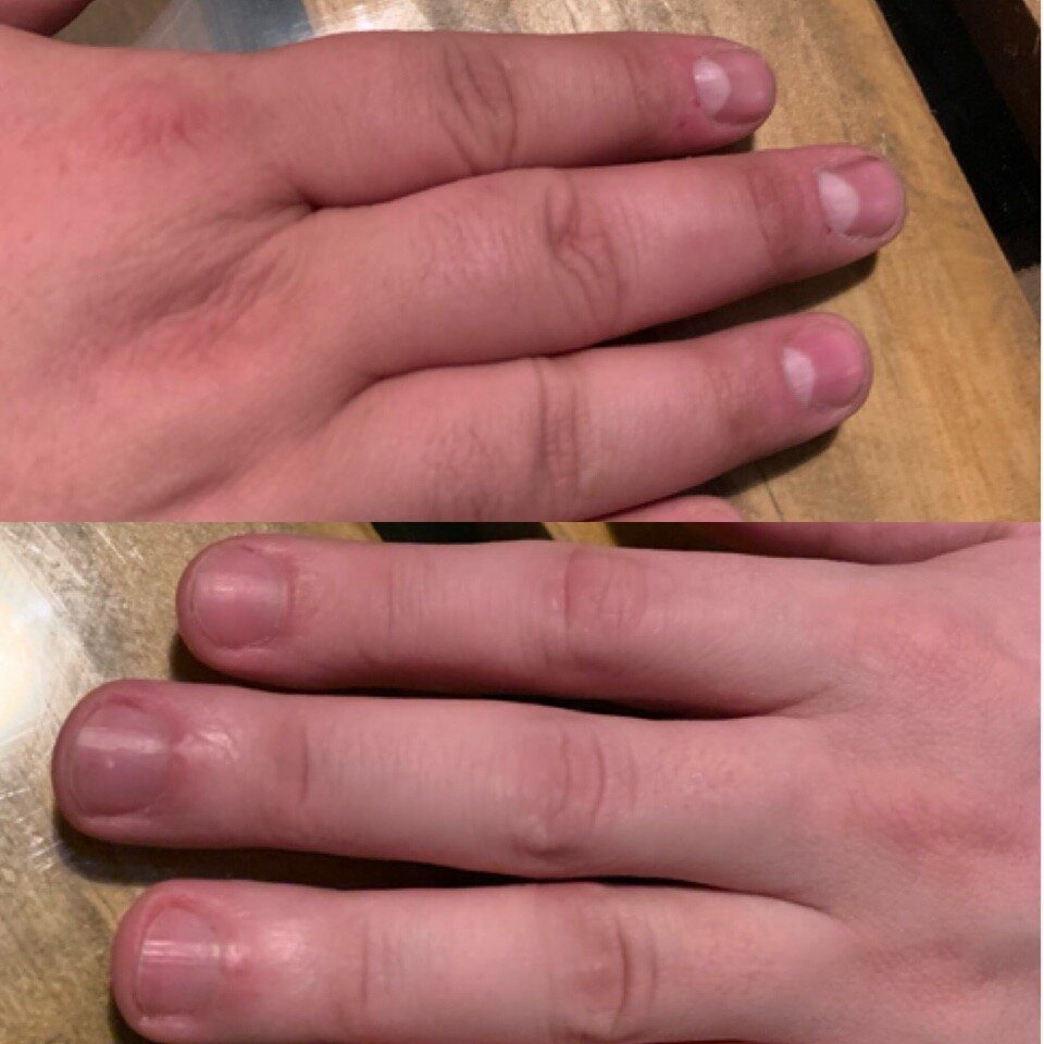 Палец толстый и большой. Мужские ногти неухоженные. Неухоженные мужские руки.