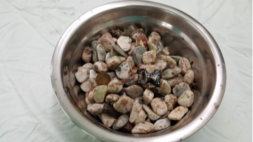 Фото: American Journal of Medical Case Reports 