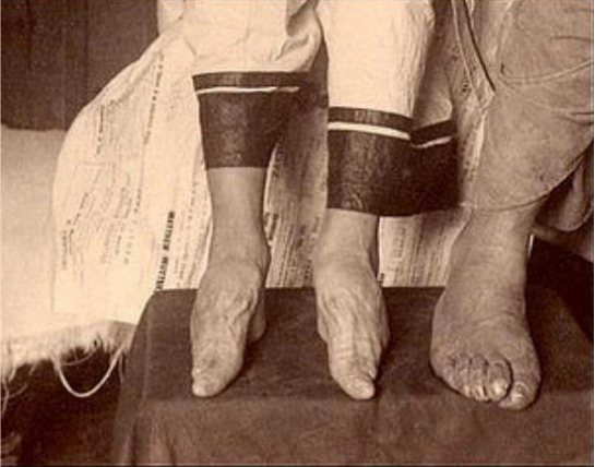 Трудно представить сколько неудобств вызывала подобная обувь