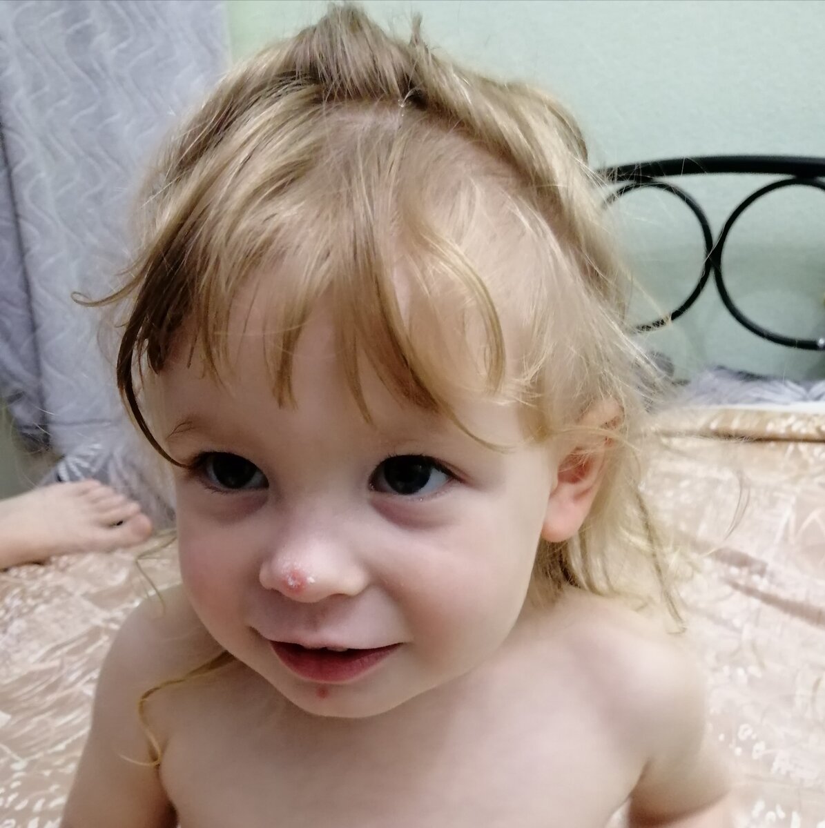 На носу, на подбородке