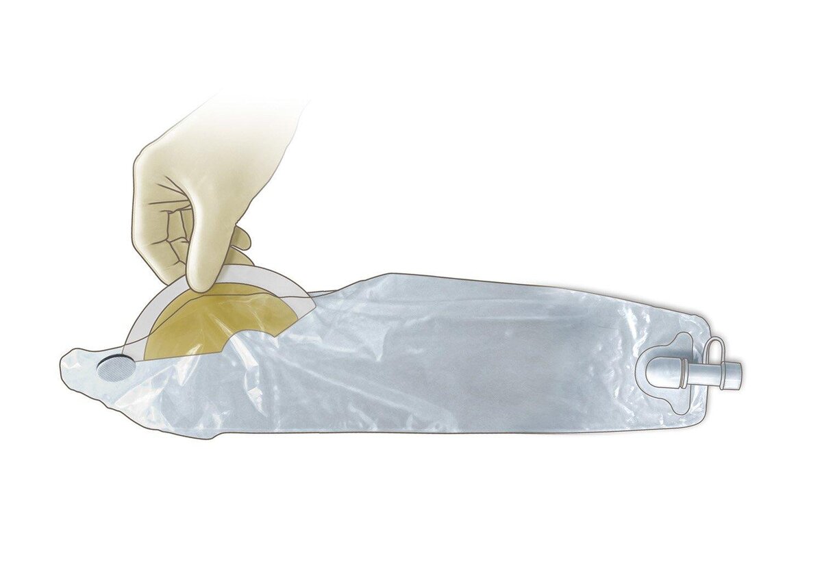 Фекальный коллектор