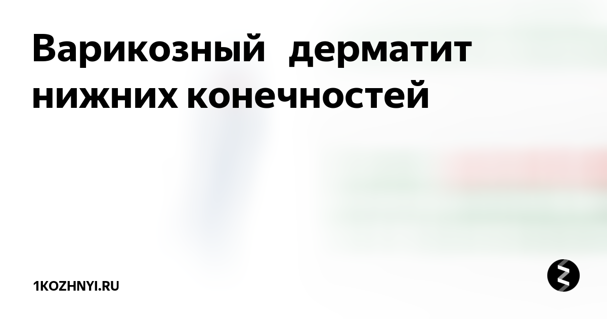 Ретикулярный варикоз нижних конечностей что это такое - симптомы и лечение вен н