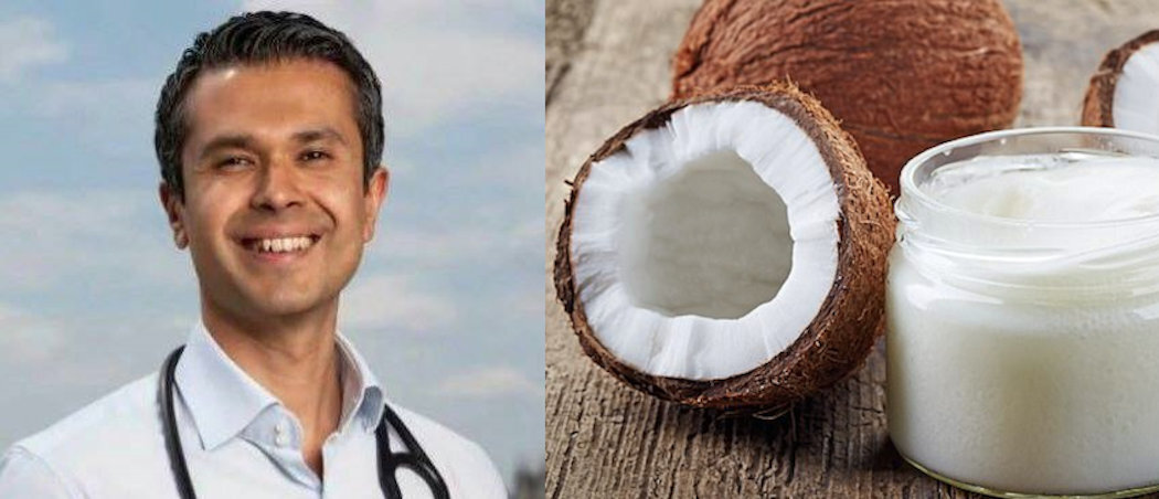 Sante. Доктор кокосов. Спрей для волос coconut hair , 150 мл. Маска для волос доктор санте кокос. Sante шампунь сoconut (кокос) 1000 мл (1 литр), для сухих и ломких волос.