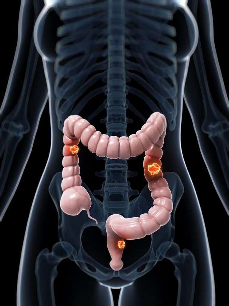 Изображение взято Парашистай