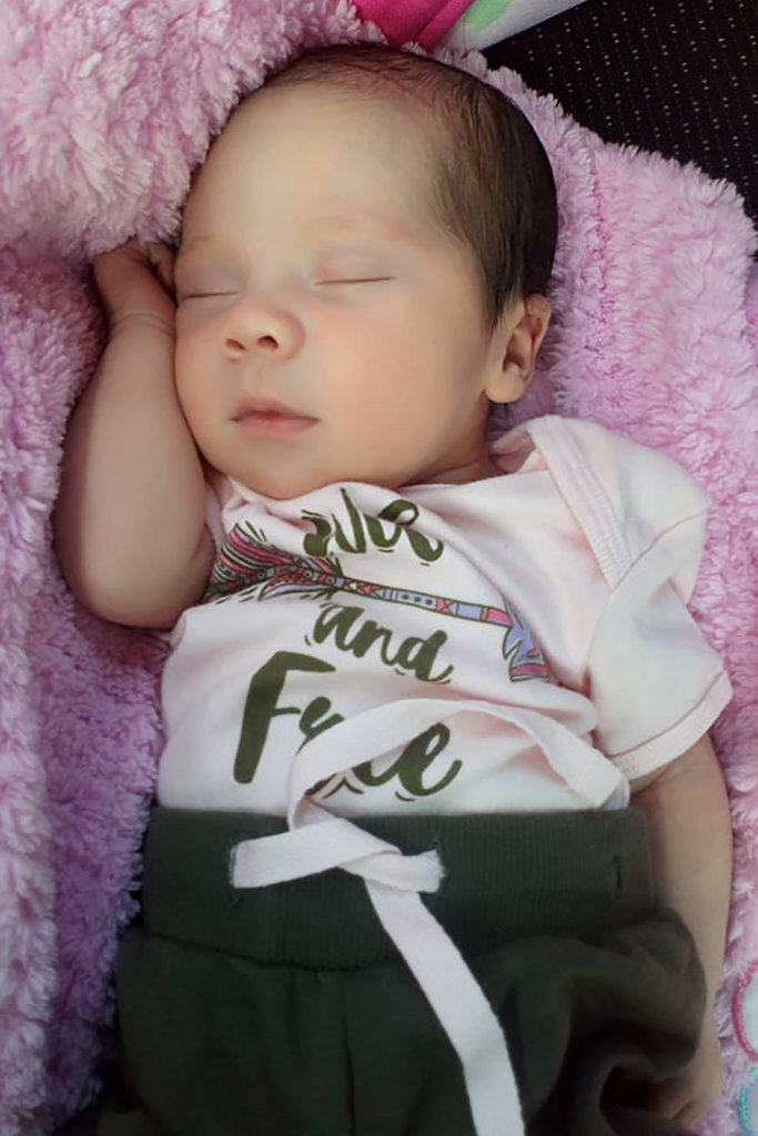 Девочка Итзамара (уже после извлечения ее сестры-близнеца)