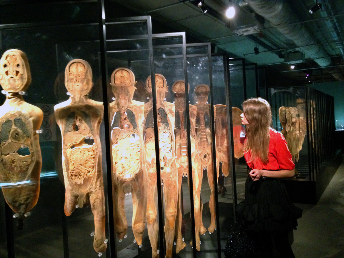 Один человек в продольных разрезах. Ужас!